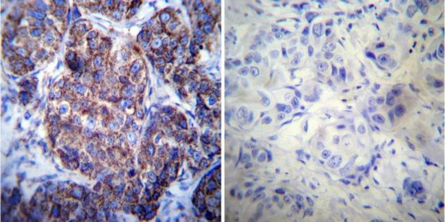 HSP60 Antibody in Immunohistochemistry (Paraffin) (IHC (P))