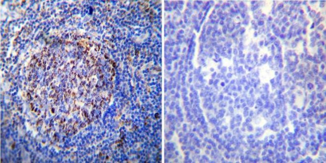 HSP60 Antibody in Immunohistochemistry (Paraffin) (IHC (P))