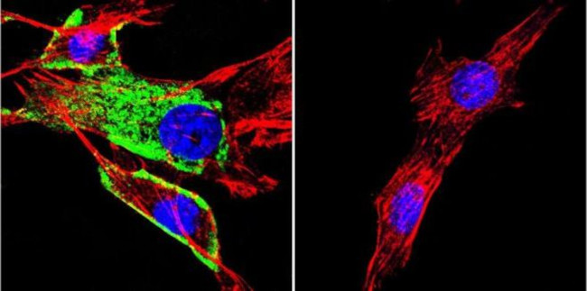 HSC70 Antibody in Immunocytochemistry (ICC/IF)