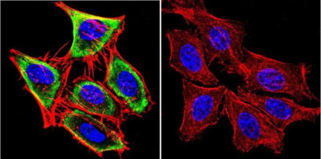 HSC70 Antibody in Immunocytochemistry (ICC/IF)