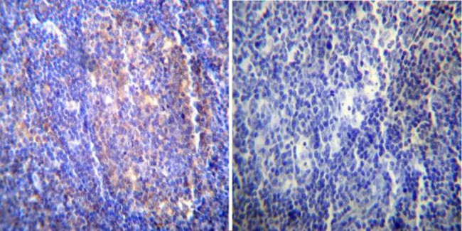 HSC70 Antibody in Immunohistochemistry (Paraffin) (IHC (P))