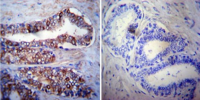 HSC70 Antibody in Immunohistochemistry (Paraffin) (IHC (P))