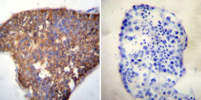 HSC70 Antibody in Immunohistochemistry (Paraffin) (IHC (P))