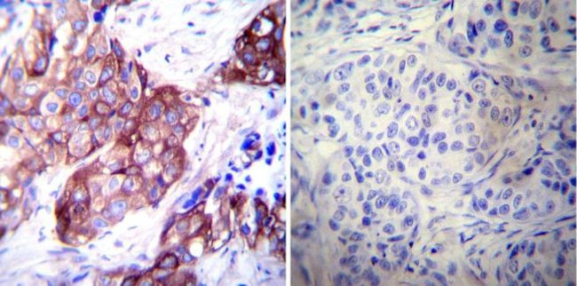 HSP27 Antibody in Immunohistochemistry (Paraffin) (IHC (P))