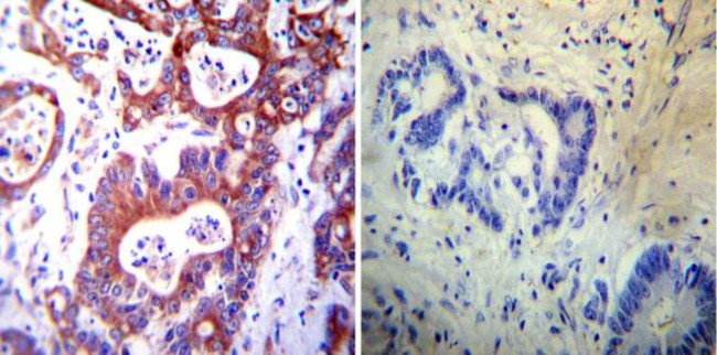 PDI Antibody in Immunohistochemistry (Paraffin) (IHC (P))