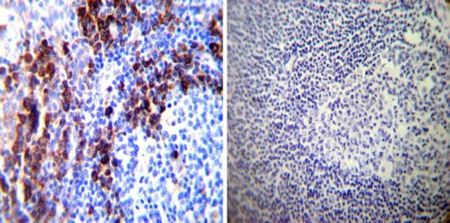 PDI Antibody in Immunohistochemistry (Paraffin) (IHC (P))