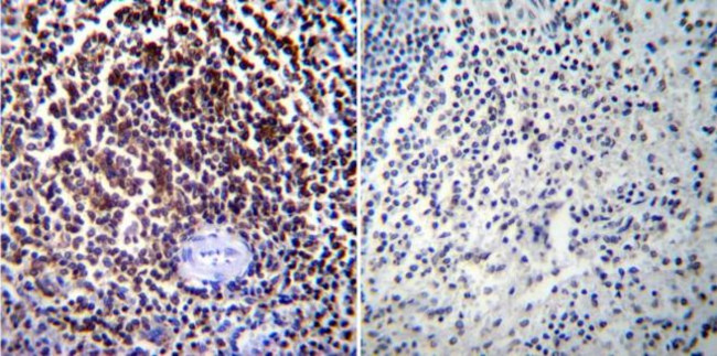 NFATC1 Antibody in Immunohistochemistry (Paraffin) (IHC (P))