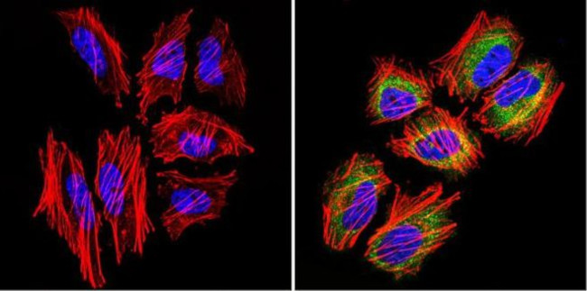 TCP1 Antibody in Immunocytochemistry (ICC/IF)