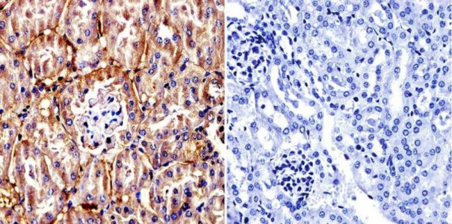 TCP1 Antibody in Immunohistochemistry (Paraffin) (IHC (P))