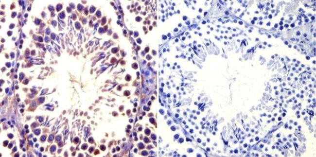 TCP1 Antibody in Immunohistochemistry (Paraffin) (IHC (P))