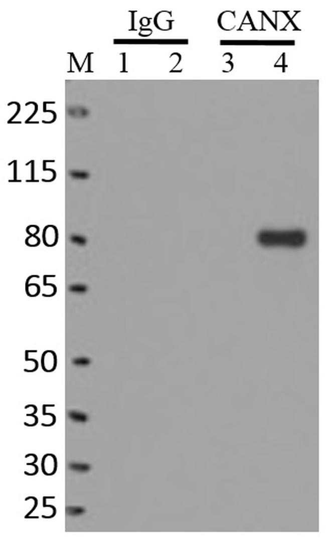 Calnexin Antibody in RNA Immunoprecipitation (RIP)