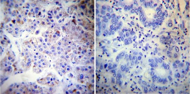 Calnexin Antibody in Immunohistochemistry (Paraffin) (IHC (P))