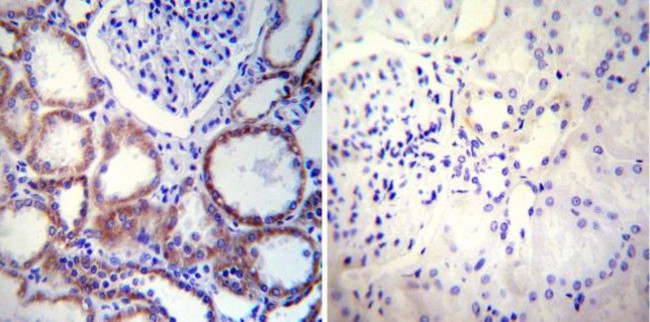 Calnexin Antibody in Immunohistochemistry (Paraffin) (IHC (P))