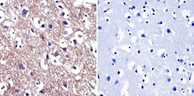 Cdc37 Antibody in Immunohistochemistry (Paraffin) (IHC (P))