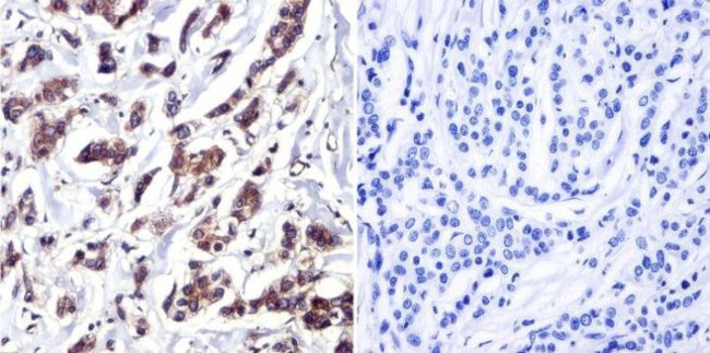 Cdc37 Antibody in Immunohistochemistry (Paraffin) (IHC (P))