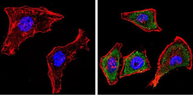 CYP1A1/CYP1A2 Antibody in Immunocytochemistry (ICC/IF)