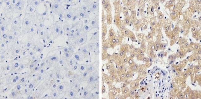 CYP1A1/CYP1A2 Antibody in Immunohistochemistry (Paraffin) (IHC (P))