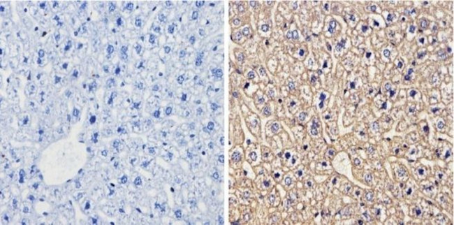 CYP1A1/CYP1A2 Antibody in Immunohistochemistry (Paraffin) (IHC (P))