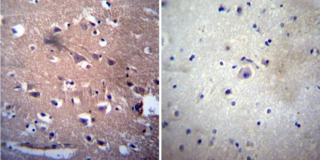 Acetylcholinesterase Antibody in Immunohistochemistry (Paraffin) (IHC (P))