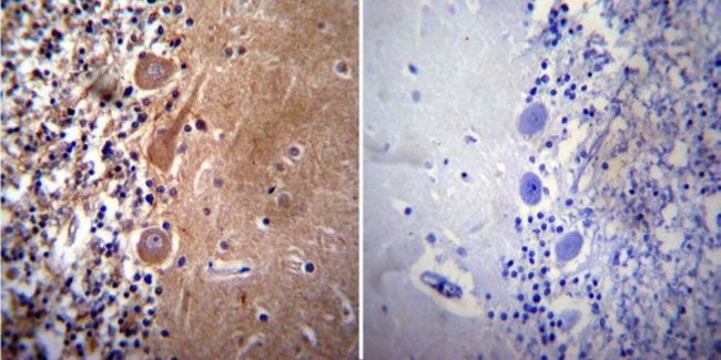 Acetylcholinesterase Antibody in Immunohistochemistry (Paraffin) (IHC (P))