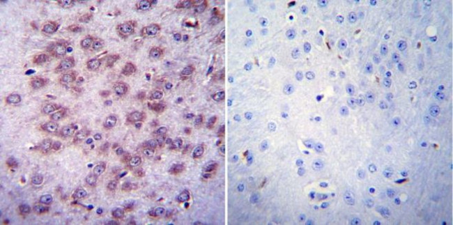 CHRNA1 Antibody in Immunohistochemistry (Paraffin) (IHC (P))