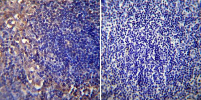 CHRNA1 Antibody in Immunohistochemistry (Paraffin) (IHC (P))