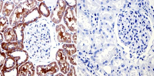 CHRM2 Antibody in Immunohistochemistry (Paraffin) (IHC (P))