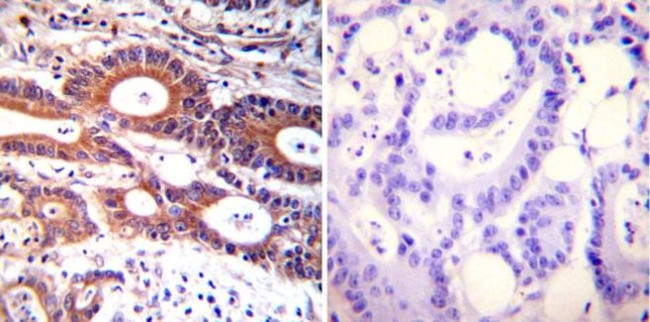 ARF1/ARF3/ARF5/ARF6 Antibody in Immunohistochemistry (Paraffin) (IHC (P))