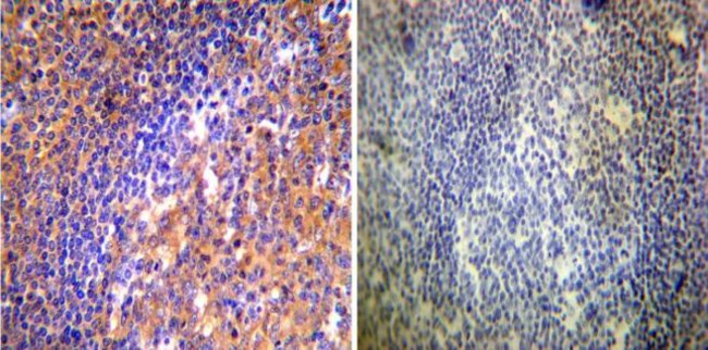 ARF1/ARF3/ARF5/ARF6 Antibody in Immunohistochemistry (Paraffin) (IHC (P))