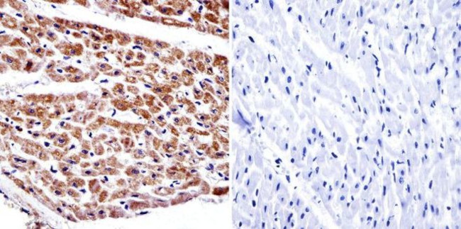 alpha Adaptin Antibody in Immunohistochemistry (Paraffin) (IHC (P))