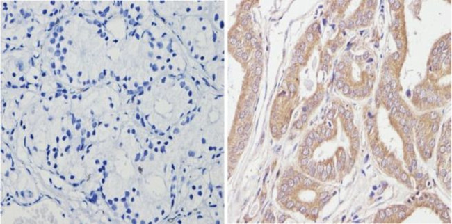 SPTBN1 Antibody in Immunohistochemistry (Paraffin) (IHC (P))