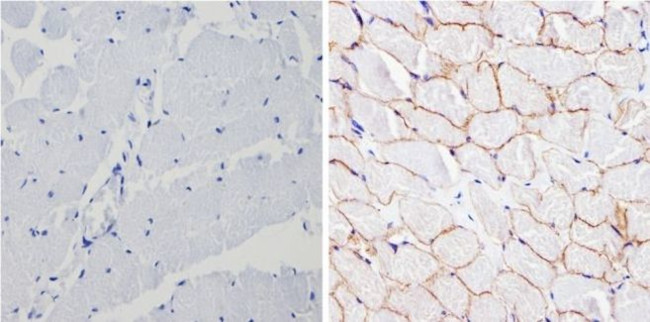 SPTBN1 Antibody in Immunohistochemistry (Paraffin) (IHC (P))