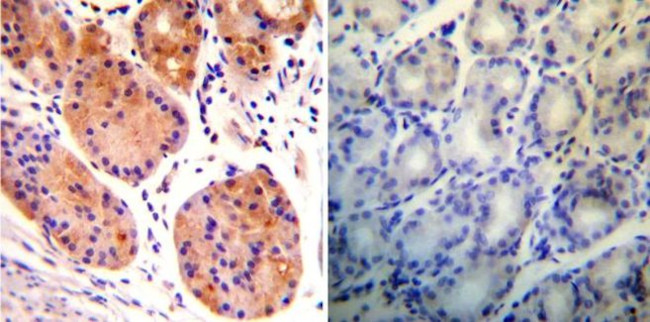 RAB9 Antibody in Immunohistochemistry (Paraffin) (IHC (P))