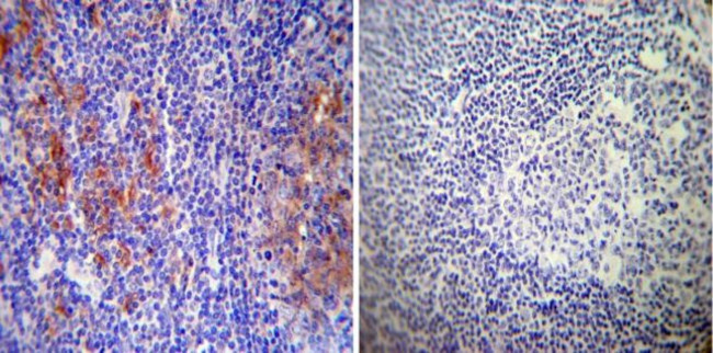 RAB9 Antibody in Immunohistochemistry (Paraffin) (IHC (P))