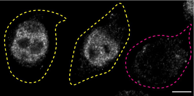 FUS Antibody in Immunocytochemistry (ICC/IF)