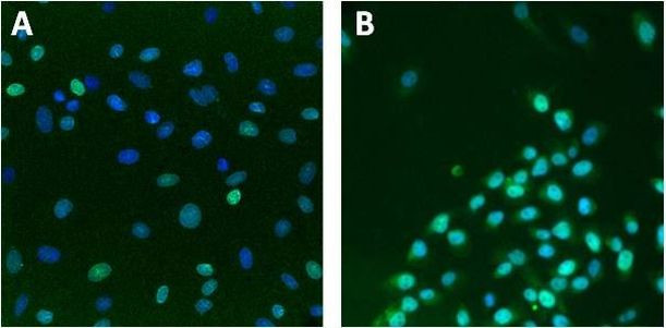 Lamin A/C Antibody in Immunocytochemistry (ICC/IF)