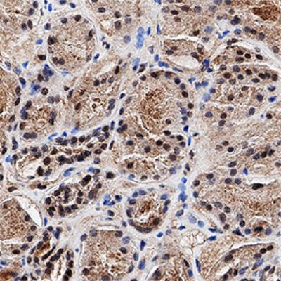 MGMT Antibody in Immunohistochemistry (Paraffin) (IHC (P))