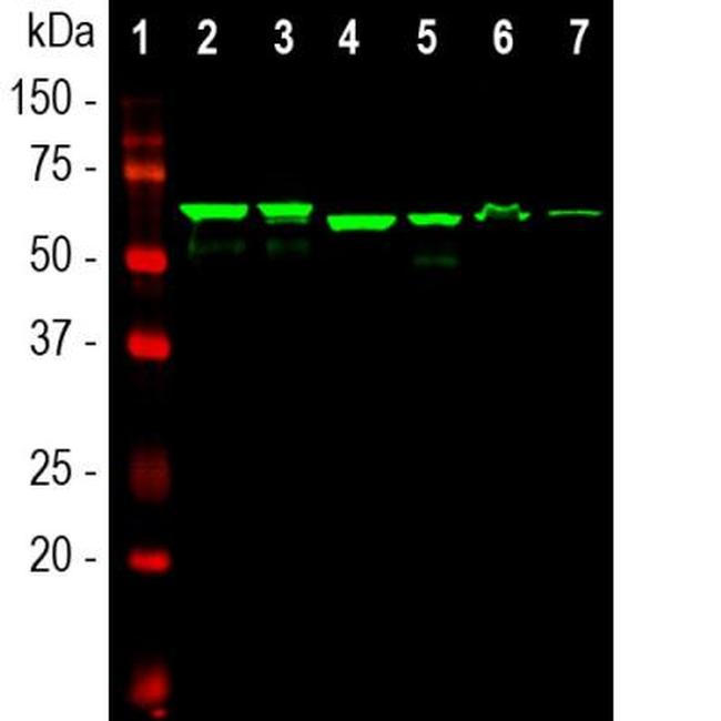 alpha Internexin Antibody in Western Blot (WB)