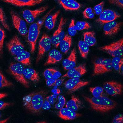 Fibrillarin Antibody in Immunocytochemistry (ICC/IF)