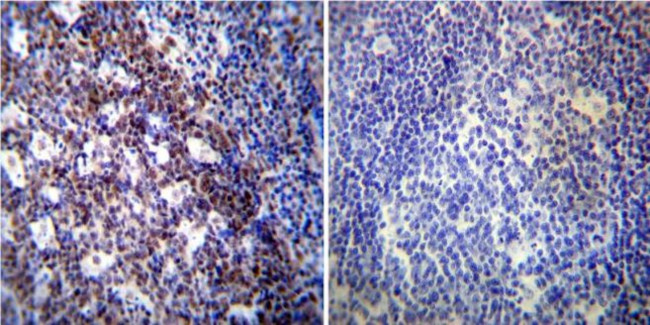 NONO Antibody in Immunohistochemistry (Paraffin) (IHC (P))