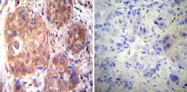 Estrogen Receptor alpha Antibody in Immunohistochemistry (Paraffin) (IHC (P))