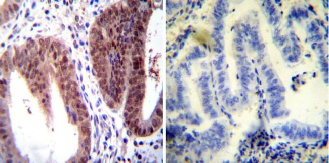 Estrogen Receptor alpha Antibody in Immunohistochemistry (Paraffin) (IHC (P))