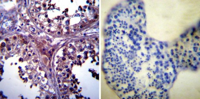 p23 Antibody in Immunohistochemistry (Paraffin) (IHC (P))