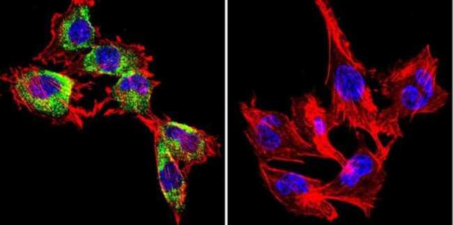 Caveolin 1 Antibody in Immunocytochemistry (ICC/IF)