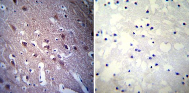 CRMP5 Antibody in Immunohistochemistry (Paraffin) (IHC (P))