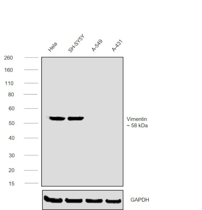 Vimentin Antibody