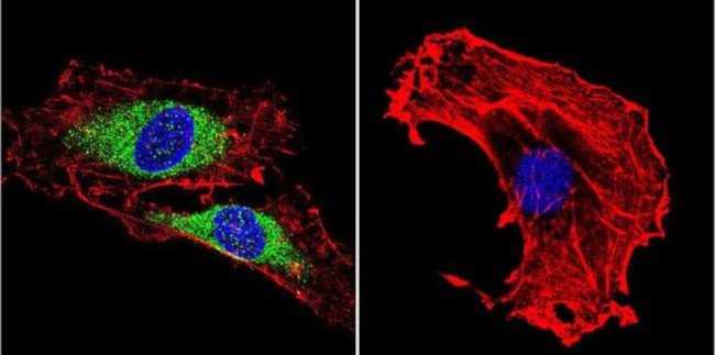 Vimentin Antibody in Immunocytochemistry (ICC/IF)