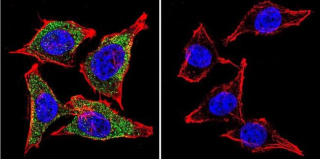 Vimentin Antibody in Immunocytochemistry (ICC/IF)