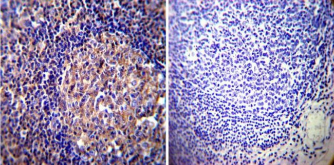 Vimentin Antibody in Immunohistochemistry (Paraffin) (IHC (P))