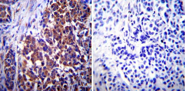 Vimentin Antibody in Immunohistochemistry (Paraffin) (IHC (P))